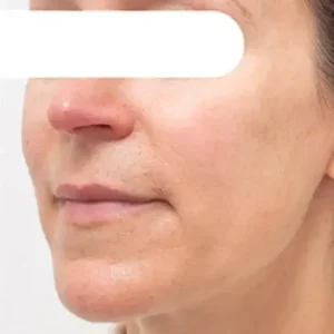 Fivfivgo™ Herbal Spots Peel-Off Facial Mask