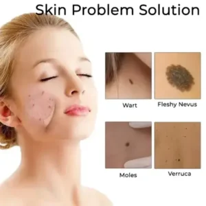 Fivfivgo™ Laser Spot Removal Pen