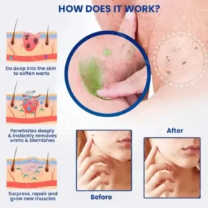Fivfivgo™ NatureErase Instant Mole & Spot Cream