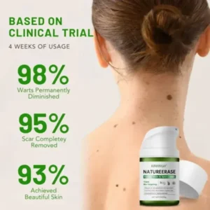 Fivfivgo™ NatureErase Instant Mole & Spot Cream