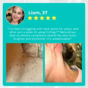 Fivfivgo™ NatureErase Instant Mole & Spot Cream